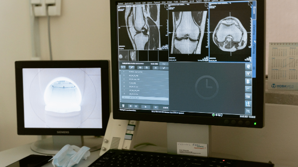 ML-BASED MEDICAL IMAGE ANALYSIS SOLUTIONS